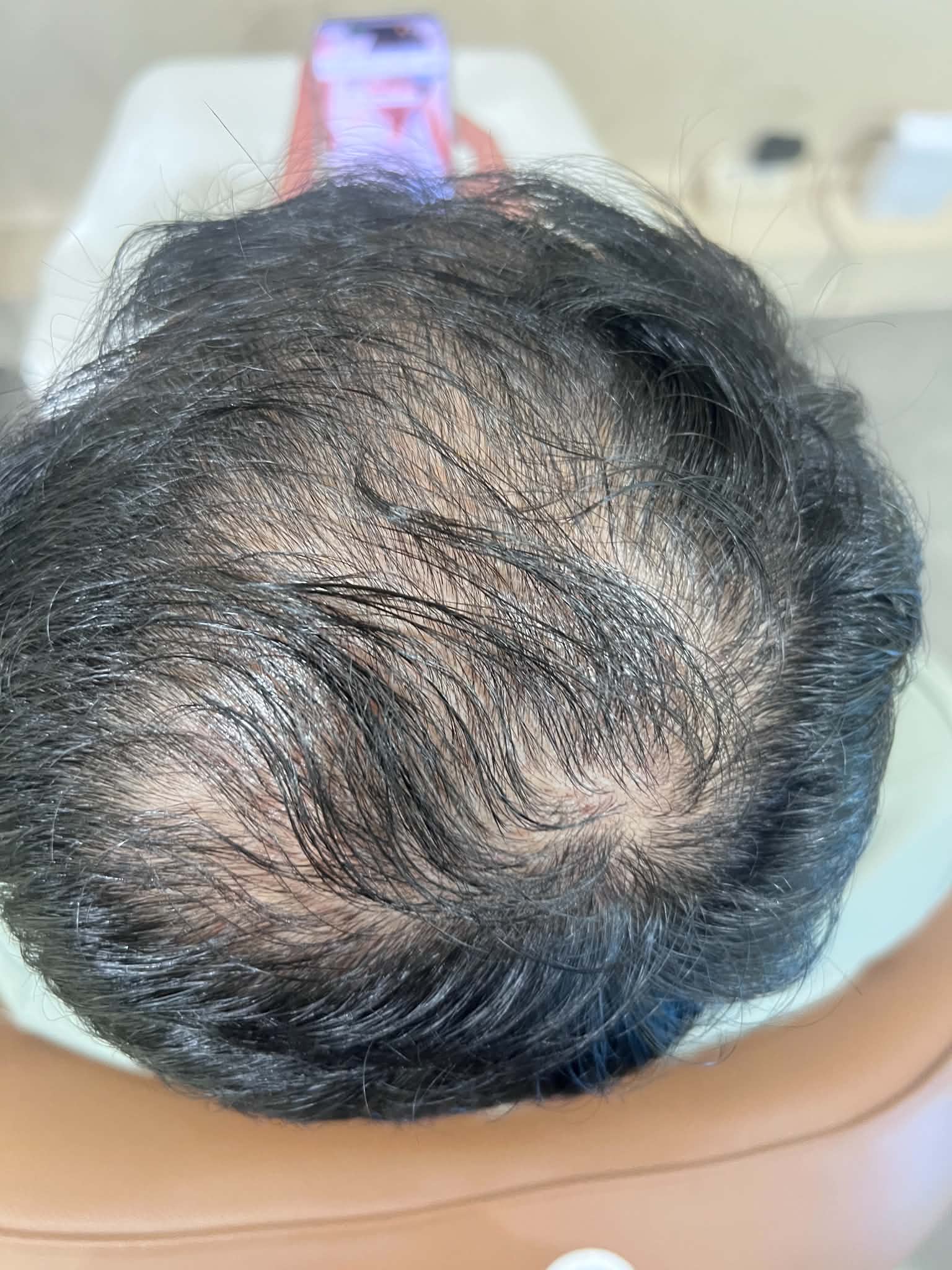 Ảnh trước - Ca 04
